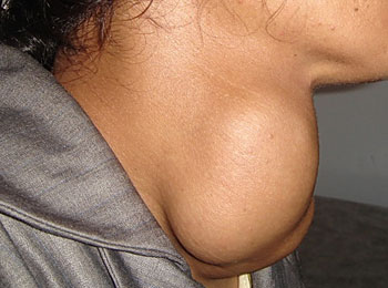 Влияние болезни щитовидной железы на женщин