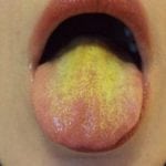 Желтый язык головная боль