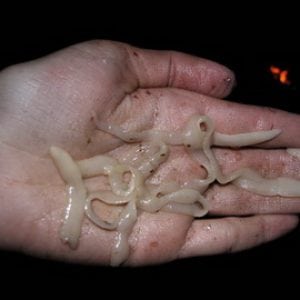 Фото паразиты в организме человека симптомы и лечение народными средствами thumbnail