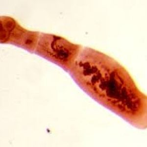 Фото паразиты в организме человека симптомы и лечение народными средствами