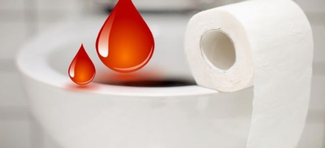 Дефекации кровь как при менструации