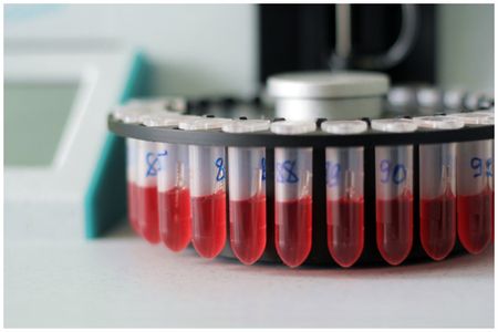 Анализ крови на паратгормон подготовка