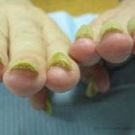 Определить болезни по ногтевой пластине с фото 112