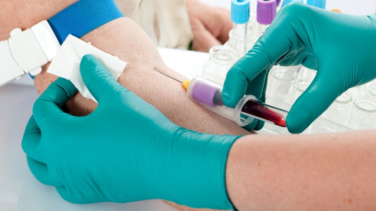Ревмопроба анализа крови расшифровка норма