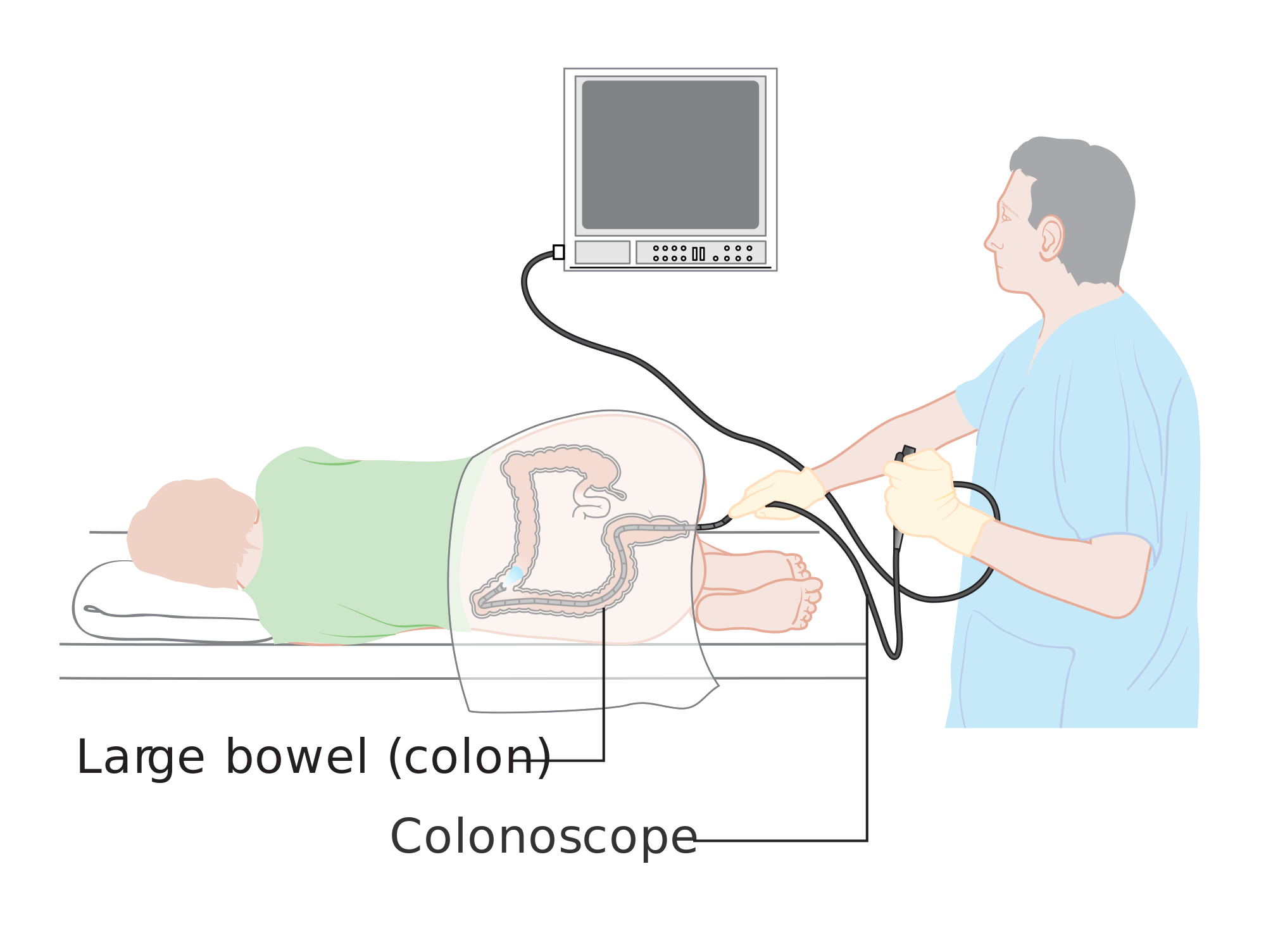 Пройти фкс. Колоноскопия кишечника ФКС. Схема колоноскопии кишечника. Эндоскопическое исследование Толстого кишечника (ректороманоскопии. Прибор для проведения колоноскопии кишечника.