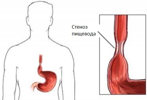 Эпигастральная область поджелудочная железа