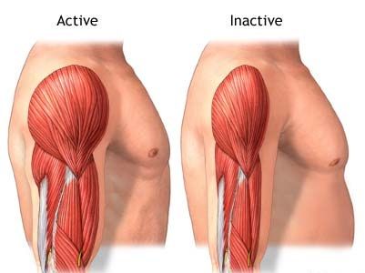 Атрофия мышцы после перелома